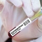 В РБ начались испытания вакцины от COVID-19