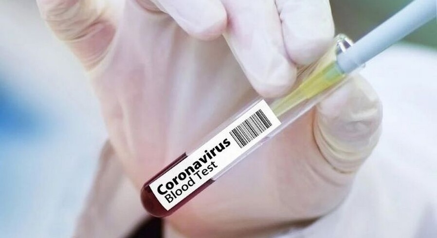 В РБ начались испытания вакцины от COVID-19